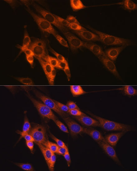 Caspase-6 Rabbit monoclonal antibody