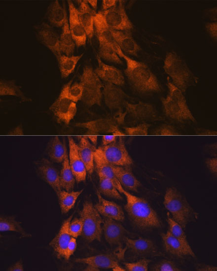 MEK1 Rabbit monoclonal antibody