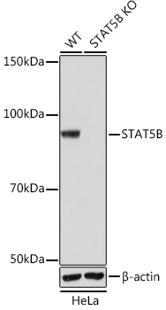 [KO Validated] STAT5B Rabbit monoclonal antibody