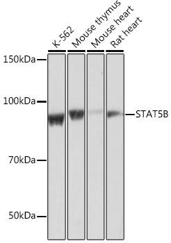 [KO Validated] STAT5B Rabbit monoclonal antibody