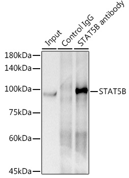 [KO Validated] STAT5B Rabbit monoclonal antibody