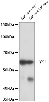 YY1 Rabbit monoclonal antibody