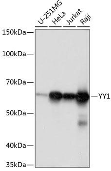 YY1 Rabbit monoclonal antibody