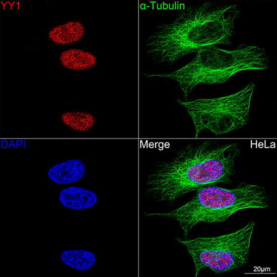 YY1 Rabbit monoclonal antibody