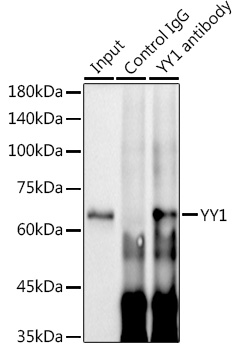 YY1 Rabbit monoclonal antibody