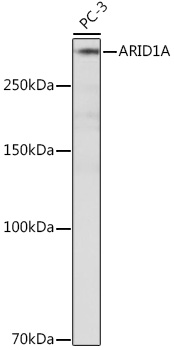 ARID1A Rabbit monoclonal antibody