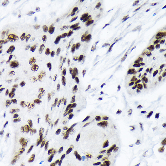 ARID1A Rabbit monoclonal antibody