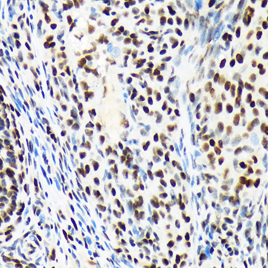 ARID1A Rabbit monoclonal antibody
