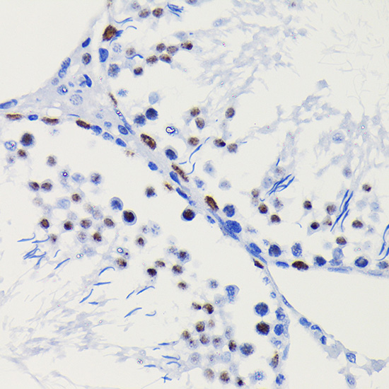 HDAC1 Rabbit monoclonal antibody