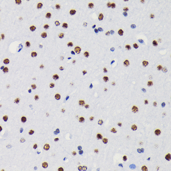 HDAC1 Rabbit monoclonal antibody