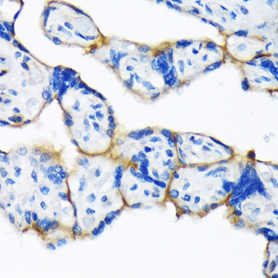 Dysferlin Rabbit monoclonal antibody