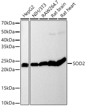 [KO Validated] SOD2 Rabbit monoclonal antibody