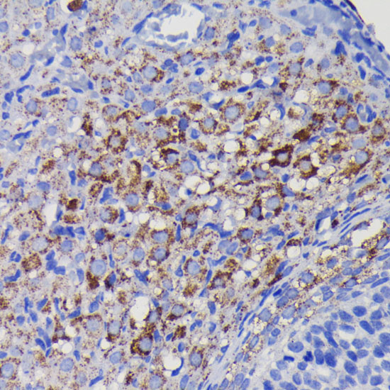 [KO Validated] SOD2 Rabbit monoclonal antibody