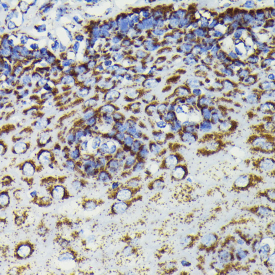 [KO Validated] SOD2 Rabbit monoclonal antibody