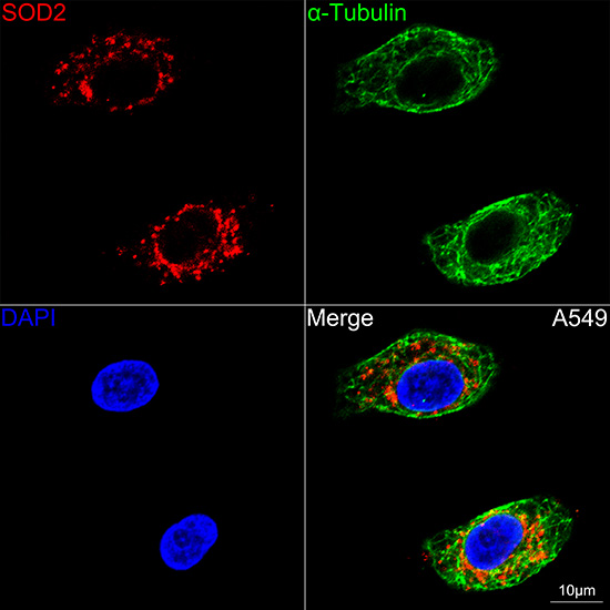 [KO Validated] SOD2 Rabbit monoclonal antibody