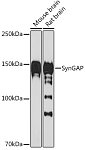 Western blot - SynGAP Rabbit mAb (A19581)