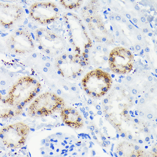 Fas Rabbit monoclonal antibody