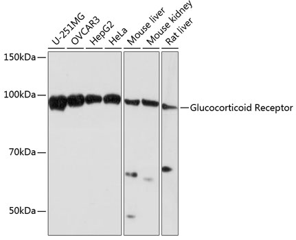 Glucocorticoid Receptor Rabbit monoclonal antibody