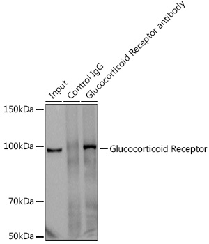 Glucocorticoid Receptor Rabbit monoclonal antibody