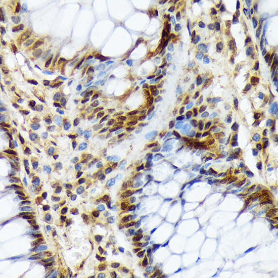 COPS3 Rabbit monoclonal antibody