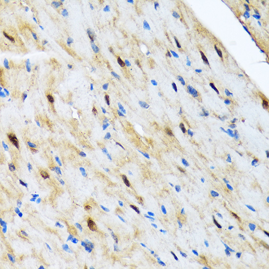 COPS3 Rabbit monoclonal antibody