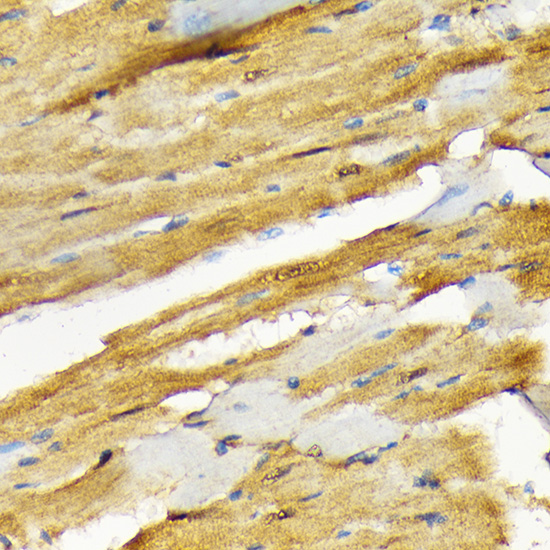 COPS3 Rabbit monoclonal antibody