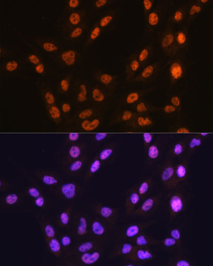 CTCF Rabbit monoclonal antibody