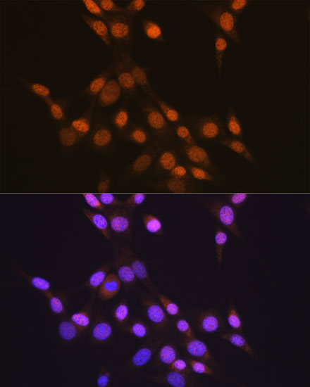 CTCF Rabbit monoclonal antibody