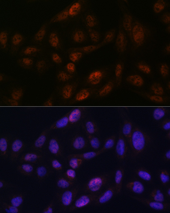 SMC3 Rabbit monoclonal antibody