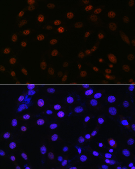 SMC3 Rabbit monoclonal antibody