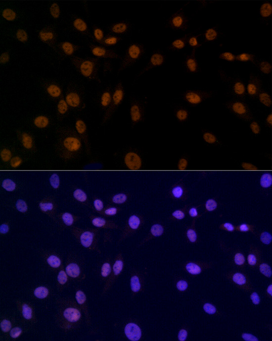 SMC3 Rabbit monoclonal antibody