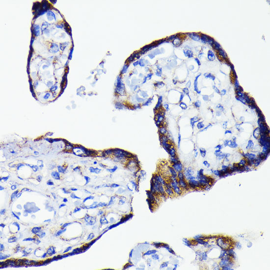 Bad Rabbit monoclonal antibody