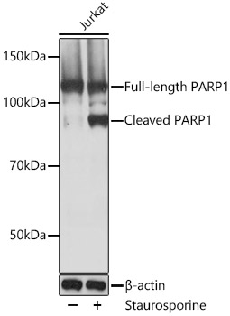 PARP1 Rabbit monoclonal antibody
