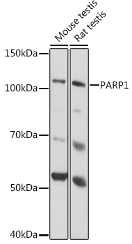 PARP1 Rabbit monoclonal antibody