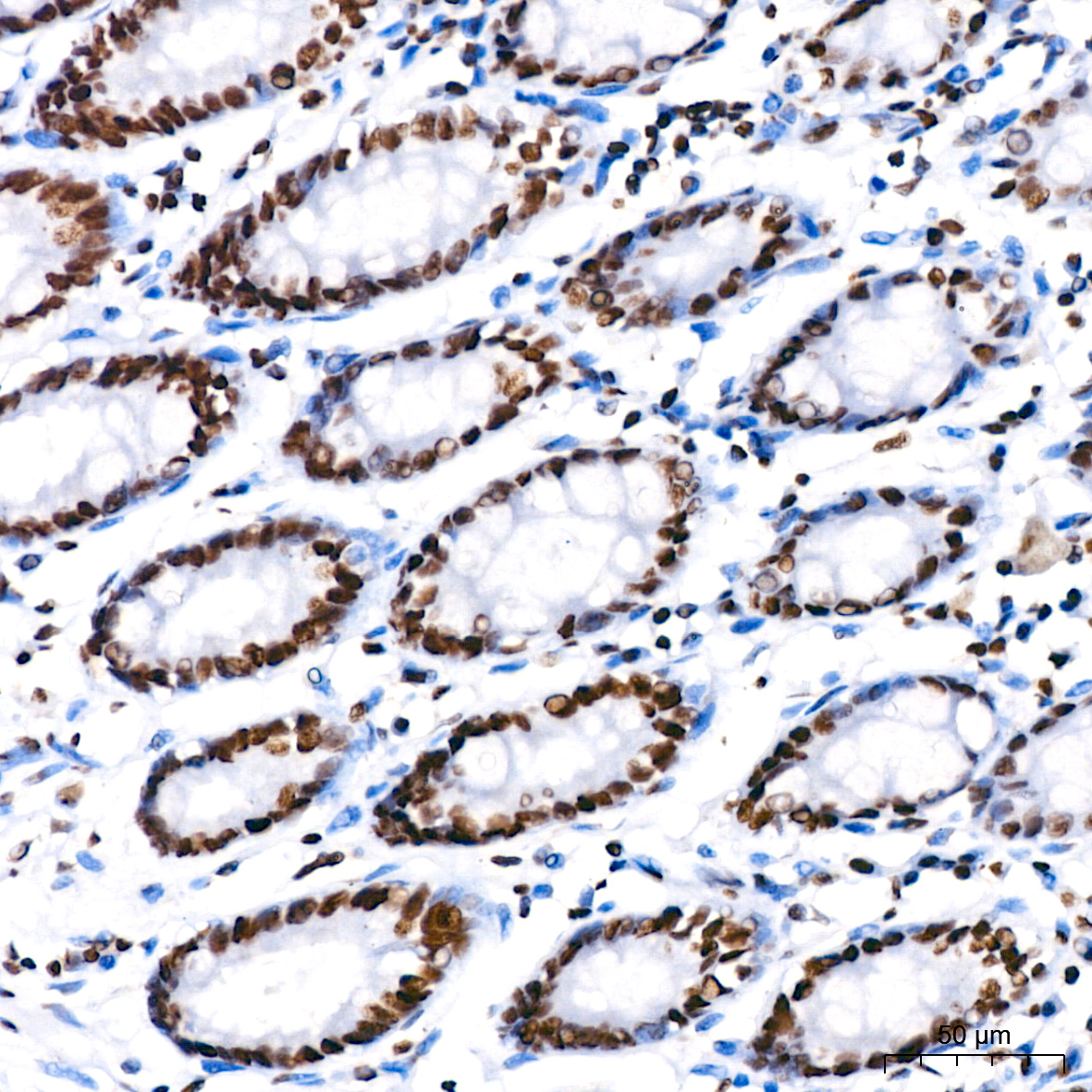 PARP1 Rabbit monoclonal antibody