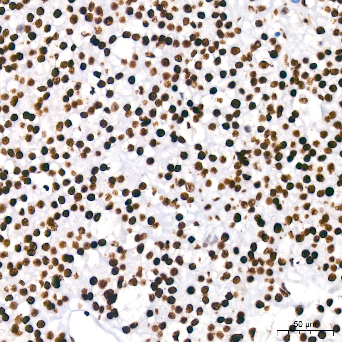 PARP1 Rabbit monoclonal antibody