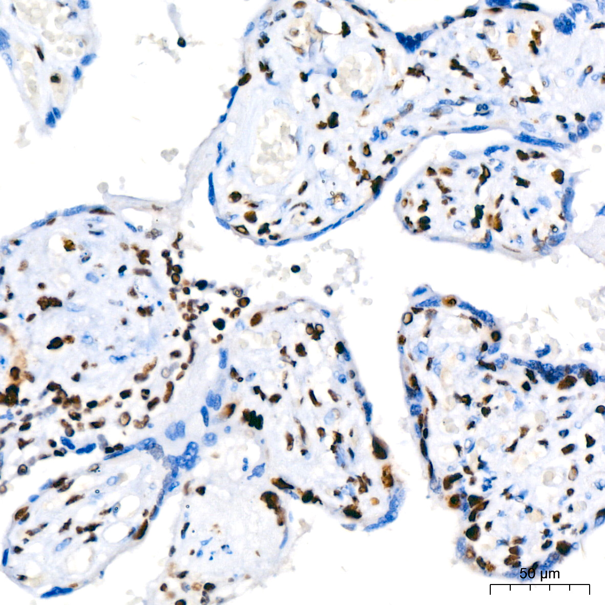 PARP1 Rabbit monoclonal antibody