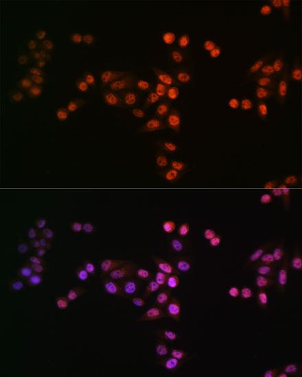 DROSHA Rabbit monoclonal antibody