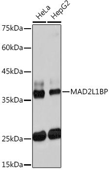 MAD2L1BP Rabbit monoclonal antibody