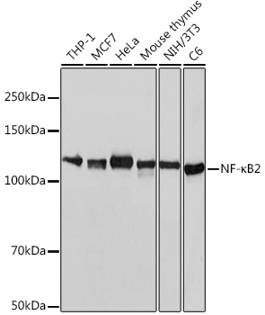 NF-K KappaB2 Rabbit monoclonal antibody