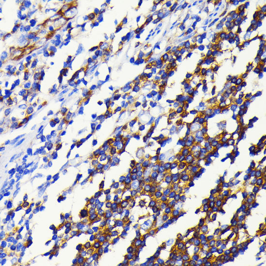 NF-K KappaB2 Rabbit monoclonal antibody