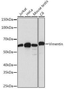 [KD Validated] Vimentin Rabbit monoclonal antibody