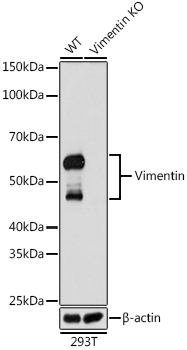 [KD Validated] Vimentin Rabbit monoclonal antibody