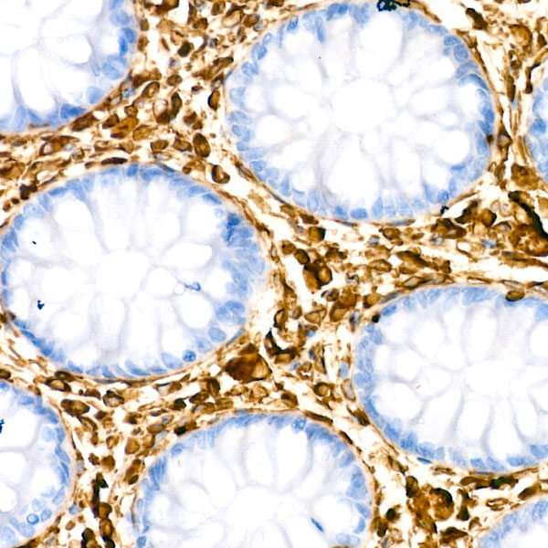[KD Validated] Vimentin Rabbit monoclonal antibody
