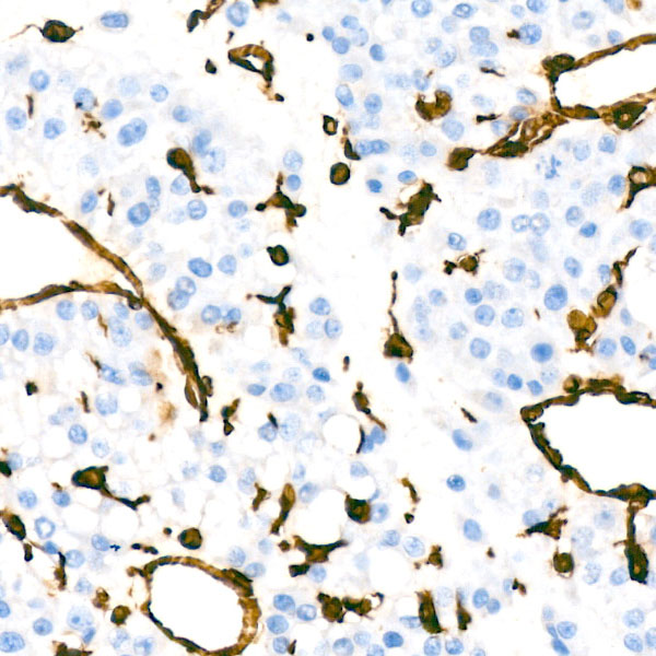 [KD Validated] Vimentin Rabbit monoclonal antibody