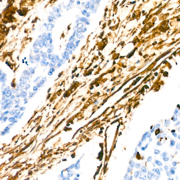 [KD Validated] Vimentin Rabbit monoclonal antibody