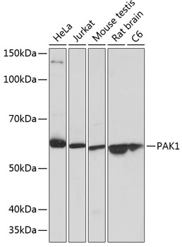 PAK1 Rabbit monoclonal antibody