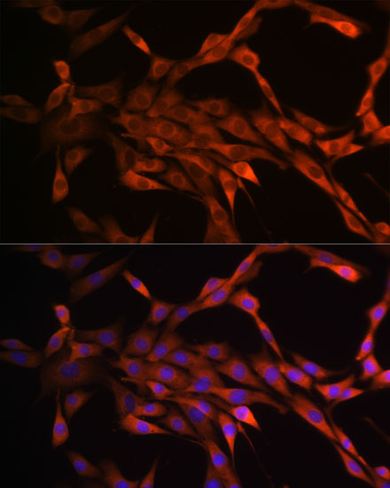 PAK1 Rabbit monoclonal antibody