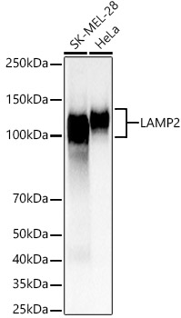 LAMP2 Rabbit polyclonal antibody
