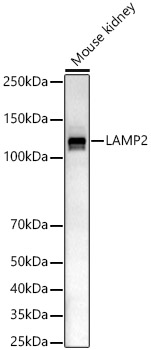LAMP2 Rabbit polyclonal antibody